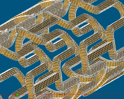3D-Mesh of a stent (with courtesy to Peter Mortier, Feops, Belgium)